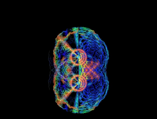An abstract brain scan image highlighting the areas of the brain that are most active when listening to music, such as the auditory cortex, amygdala, and hippocampus. Use bright colors to indicate high levels of activity.
